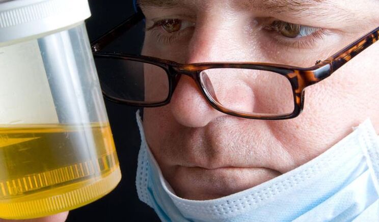 Urinanalyse bei chronischer Prostatitis